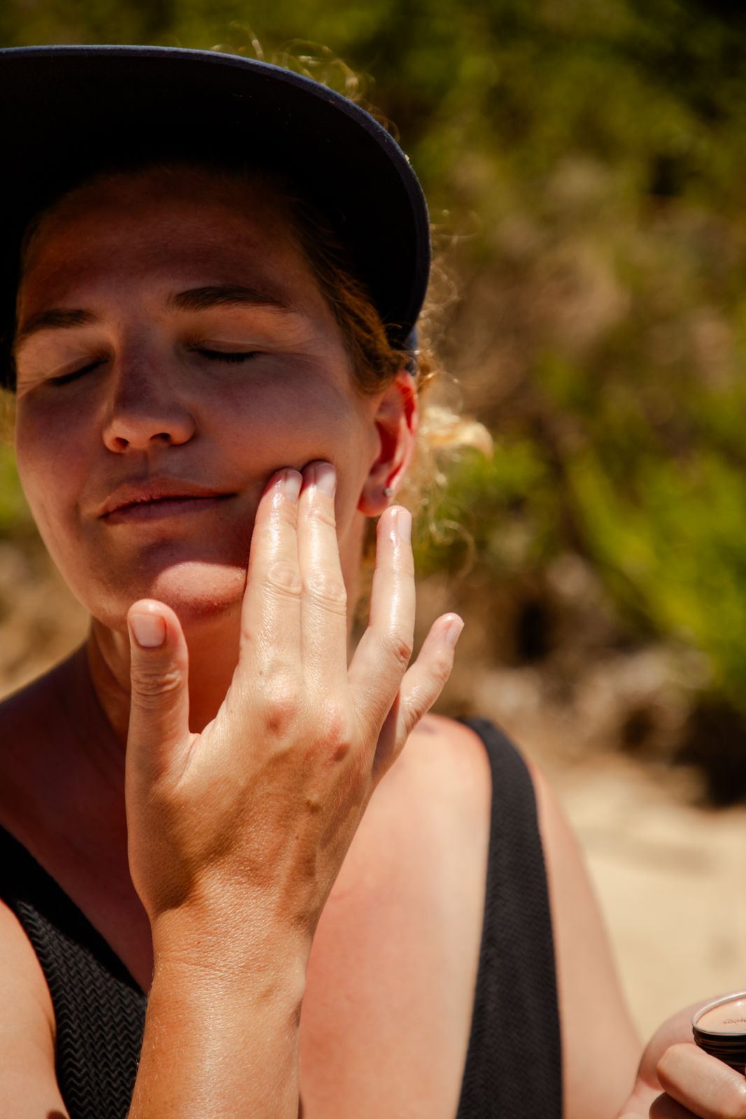 Protecting Your Skin: The Role of Sun Protection in Managing Melasma